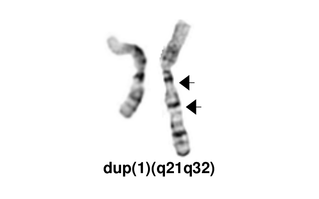 dup(1)(q21q32)