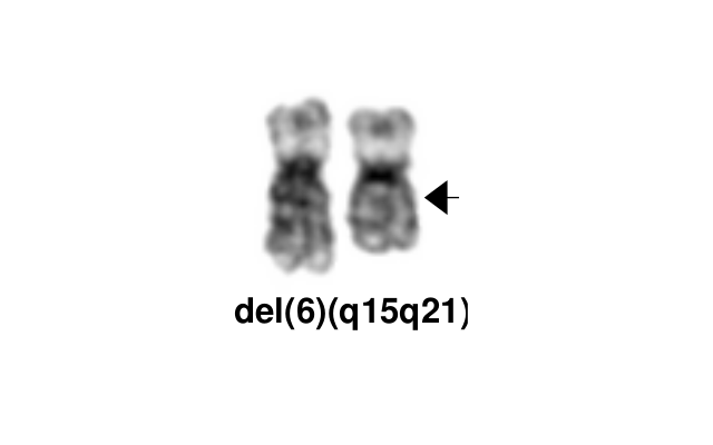 del(6)(q15q21)