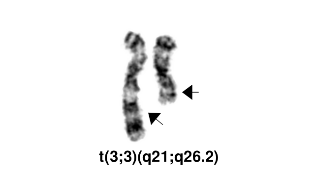 t(3;3)(q21;q26.2)