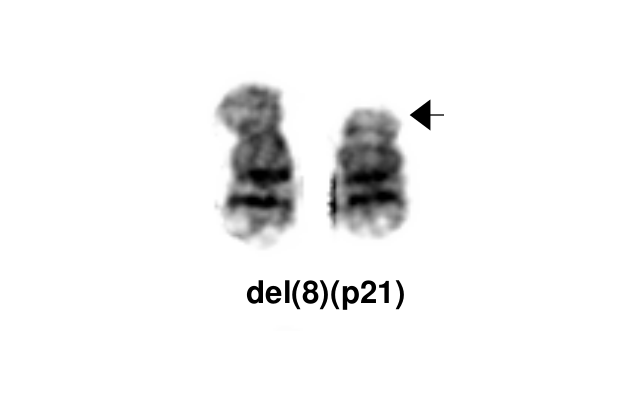 del(8)(p21)