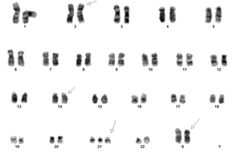 Karyotype.jpg