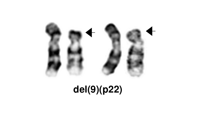 del(9)(p22)