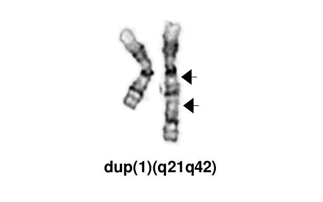 dup(1)(q21q42)