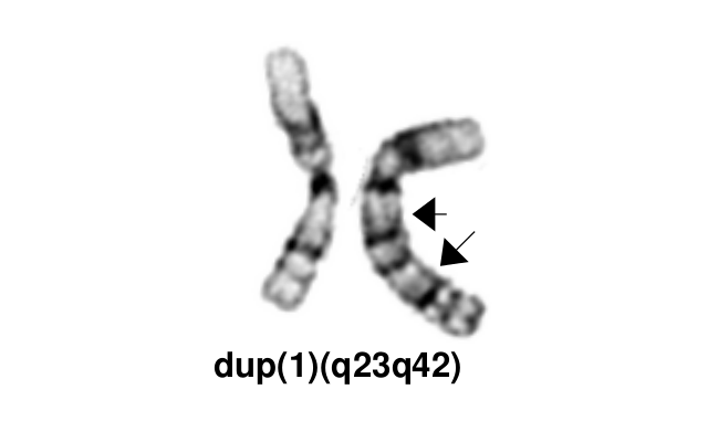 dup(1)(q23q42)