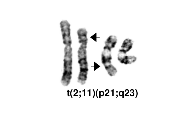 t(2;11)(p21;q23)