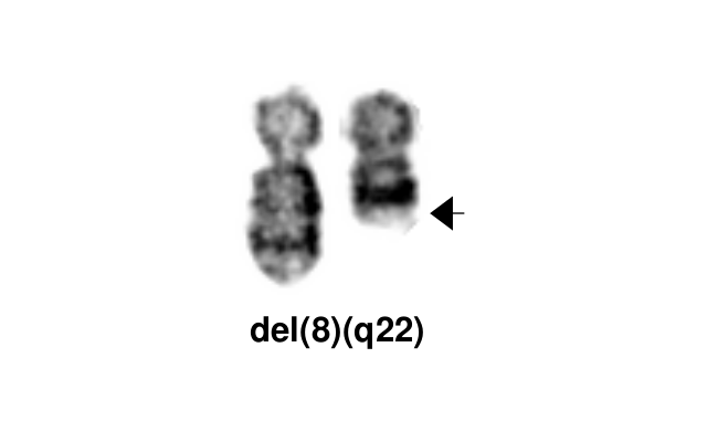 del(8)(q22)