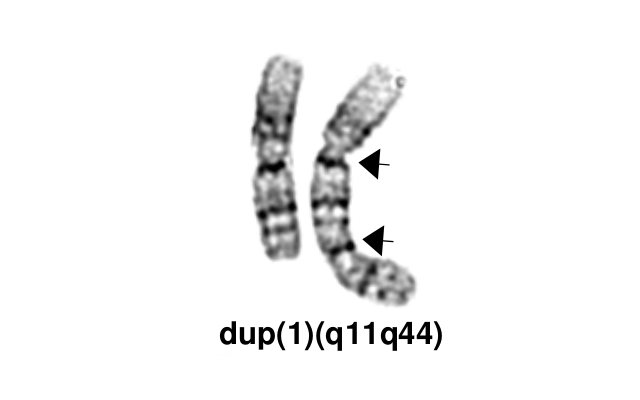 dup(1)(q11q44)