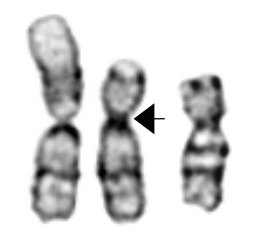 Example translocation.png