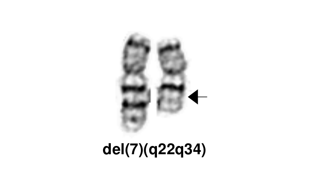 del(7)(q22q34)