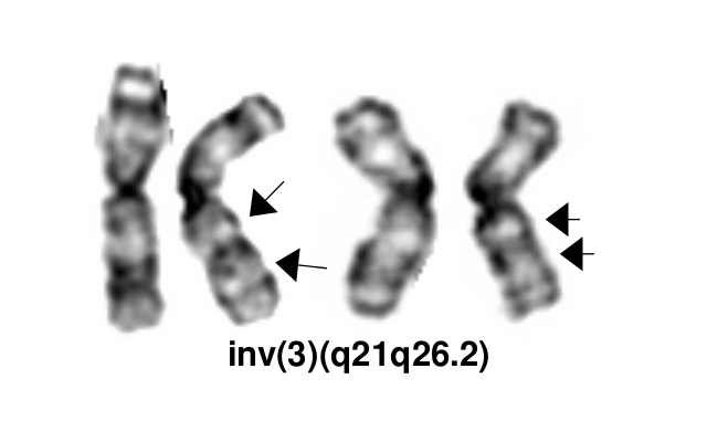 inv(3)(q21q26.2)