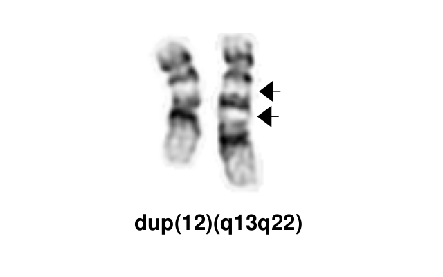 dup(12)(q13q22)