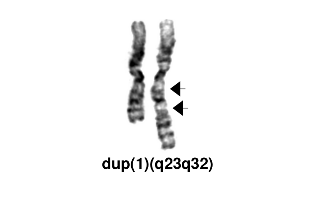 dup(1)(q23q32)
