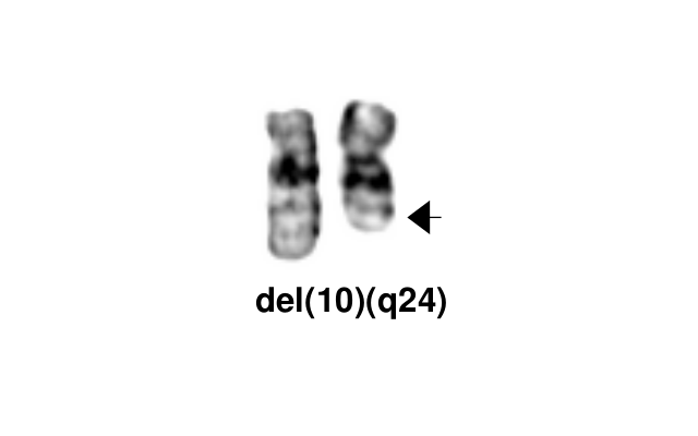 del(10)(q24)