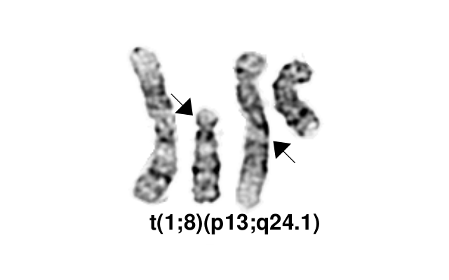 t(1;8)(p13;q24.1)