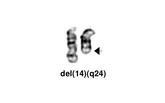 del(14)(q24)