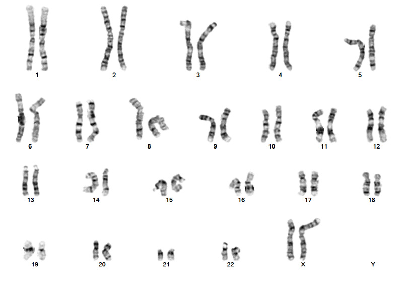 File:I(X)(q10).tif