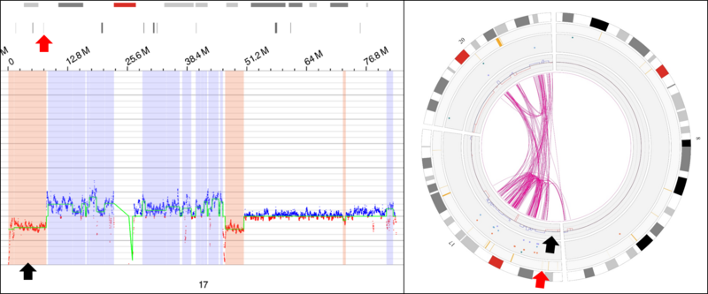 File:OGM TP53 loss.tif