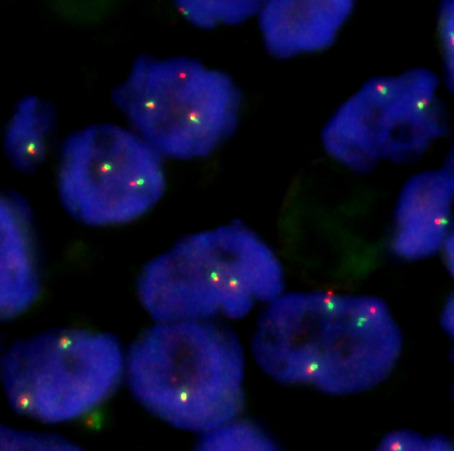 File:Negative MYB FISH.tif