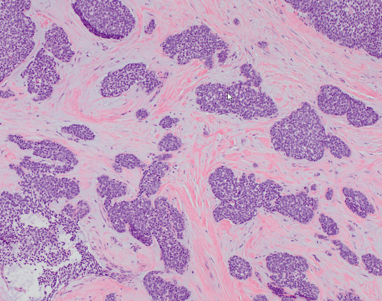 File:10x AdCC HE stain.tif