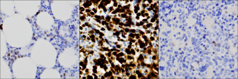 File:TP53 IHC panel.tif